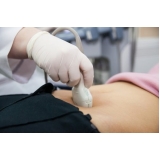 clínicas que têm ultrassom pélvico Parque do Carmo