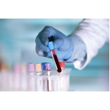 Exames Básicos de Sangue
