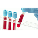 Exames de Rotina de Sangue