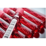 Exames de Sangue para Tireoide