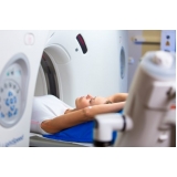 exames de tomografia computadorizada cerebral Anália Franco