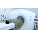 exames de tomografia computadorizada com sedação Mooca
