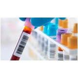 laboratório exame beta hcg consulta Engenheiro Goulart