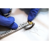 laboratório exame toxicológico Parque do Carmo