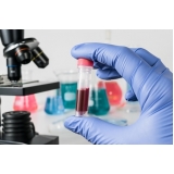 laboratórios exames beta hcg Aricanduva