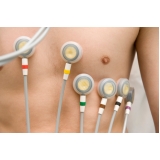 onde tem exame de eletrocardiograma Itaquera