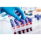 onde tem laboratório exame hemograma Ermelino Matarazzo