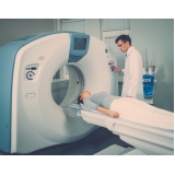 Tomografia Computadorizada de Cranio