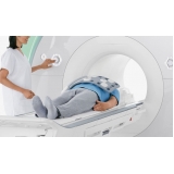 Tomografia Computadorizada do Tórax