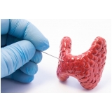 ultrassom unção aspirativa por agulha fina Vila Matilde